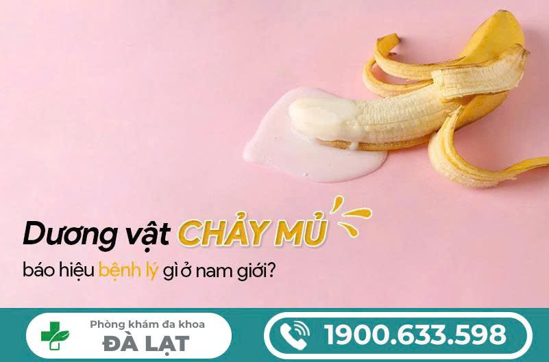 Hình ảnh minh họa